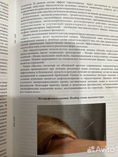 Рефлексотерапия и гирудотерапия