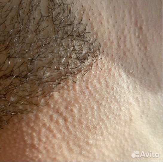 Восковая/сахарная депиляция/эпиляция/шугаринг