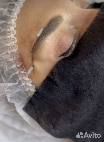 Булхорн броулифтинг