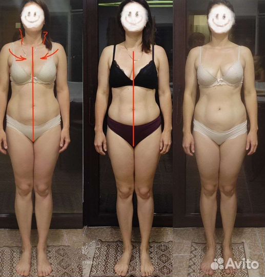 Массаж - реабилитация (оздоровление)