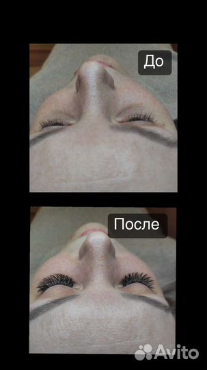 Наращивание ресниц