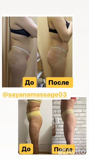 Массажиста