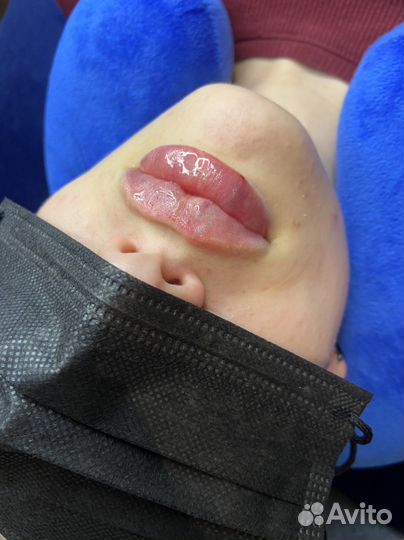 Модель на увеличение губ