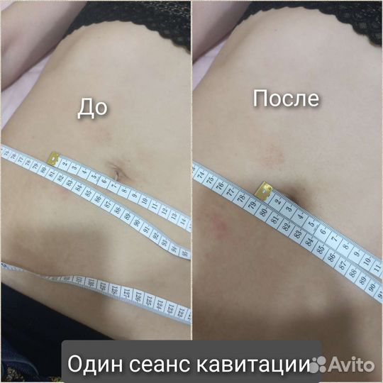 Модель для похудения