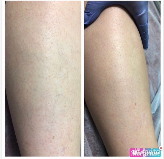 Мастер по шугарингу