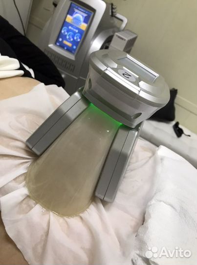 Криолиполиз (разрушение жира с помощью холода)