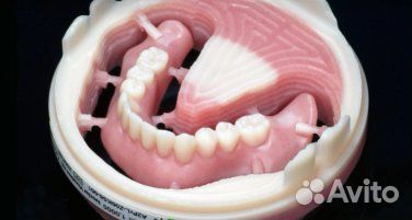 Стоматология зубные протезы