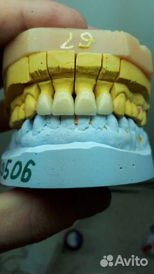 Зубной техник