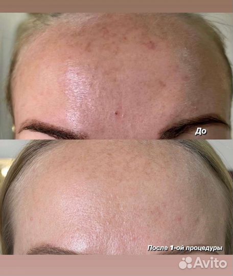 Услуги косметолога