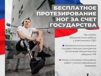 Протезирование после сво. Протезы ног бесплатно