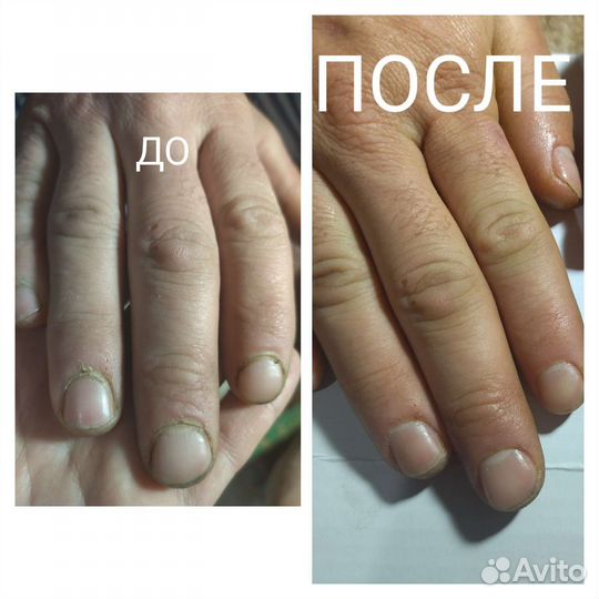 Маникюр педикюр