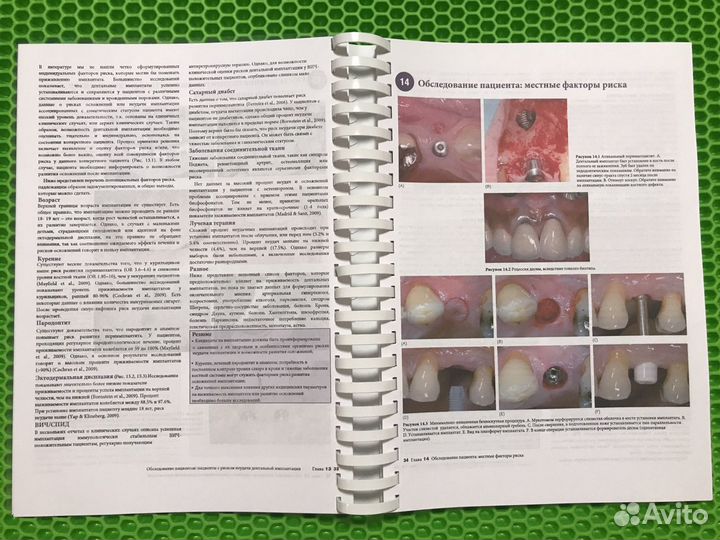 Основы имплантологии