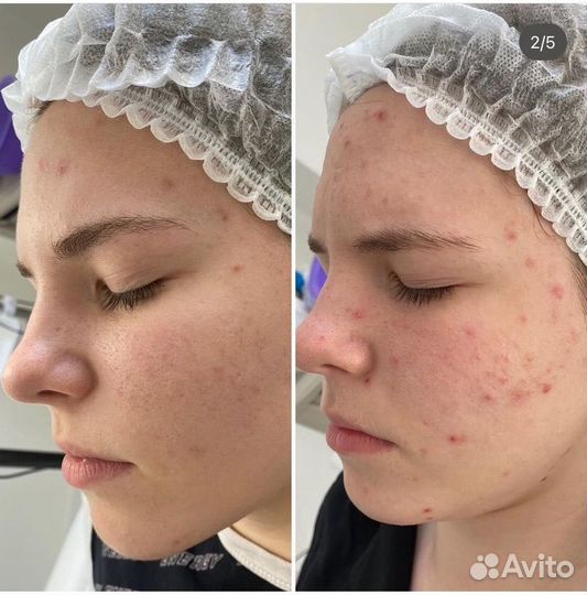 Косметолог Красноармейский