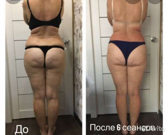 Моменталиное сжигание жиров