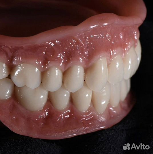 Ремонт зубных протезов. Гарантия