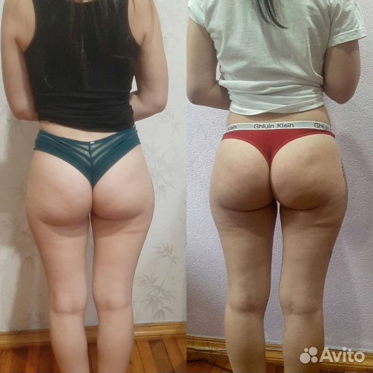 Антицеллюлитный массаж