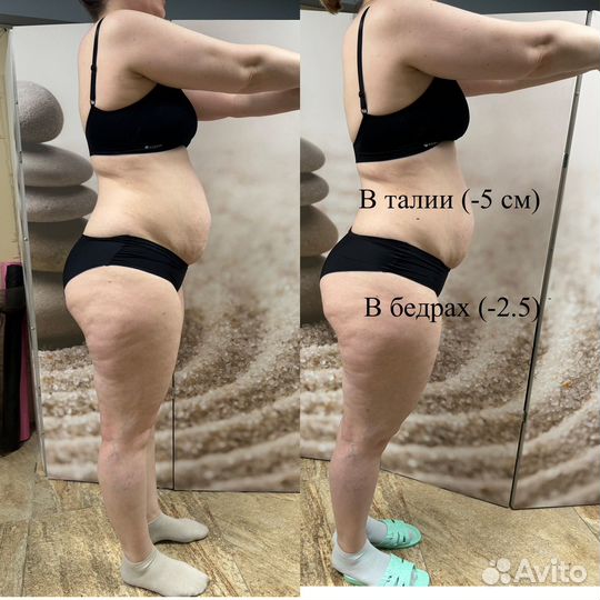 LPG лпг массаж