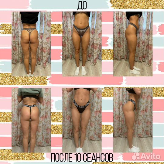 Модели на Антицеллюлитный массаж. Коррекция фигуры