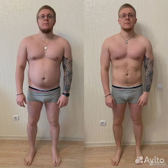 Минус 5 см за 1 процедуру. Криолиполиз