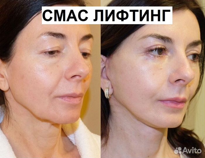 Четкий овал лица