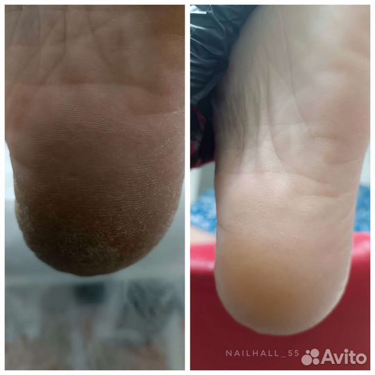 Маникюр/педикюр