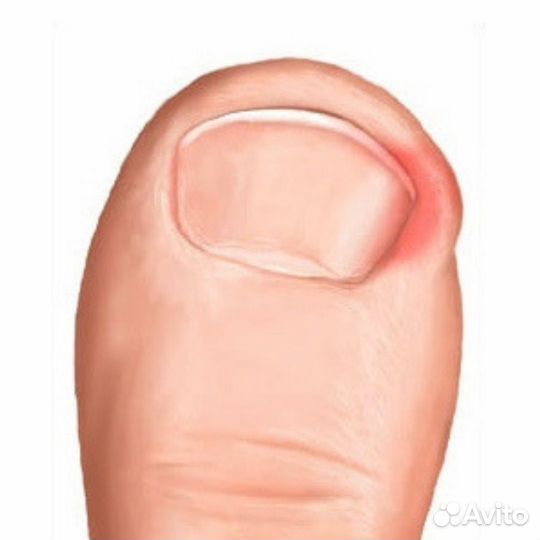 Модель на педикюр