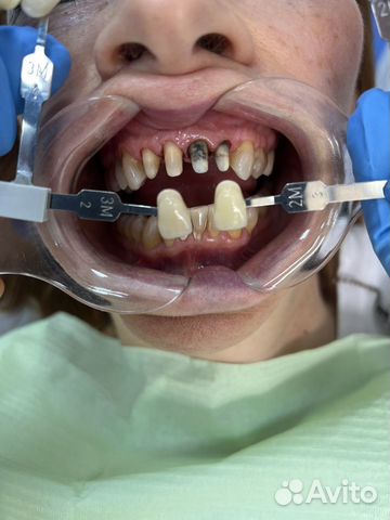 Врач - стоматолог ортопед объявление продам