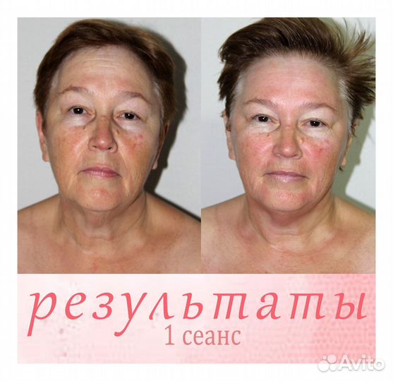 Массаж лица