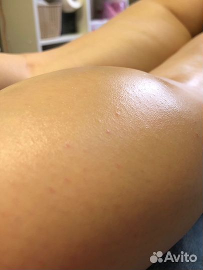 Депиляция воском