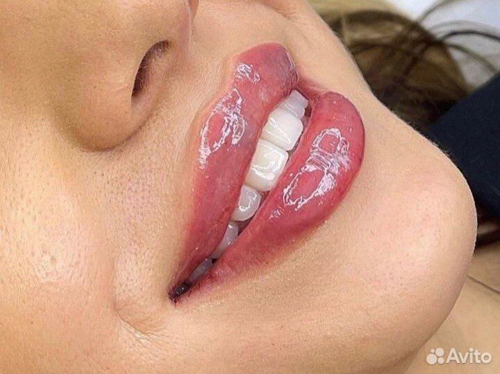 Губы /подбородок /ботокс/скулы