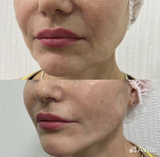 Нити Metod, Aptos, Аптос, Ког, Молдинги