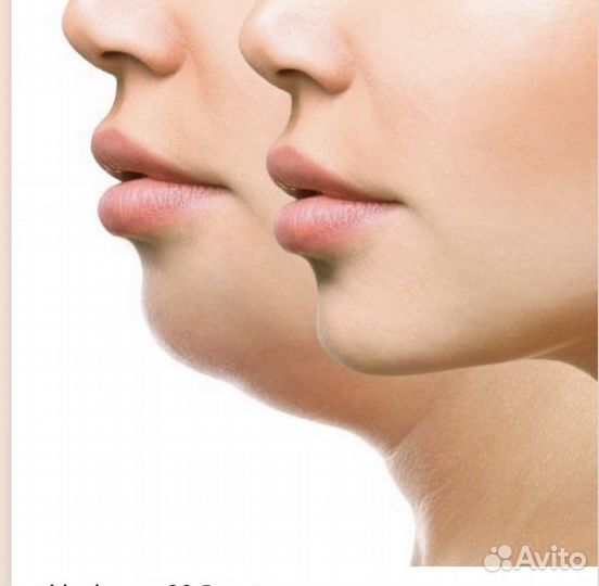 Холодная плазма