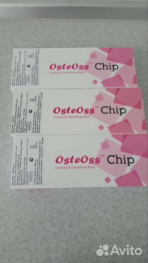Osteoss chip