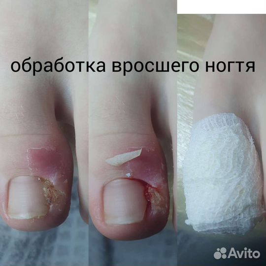Услуги подолога