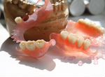 Изготовление зубных протезов (зубов )