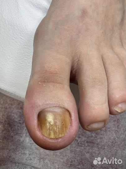 Мастер педикюра подолог