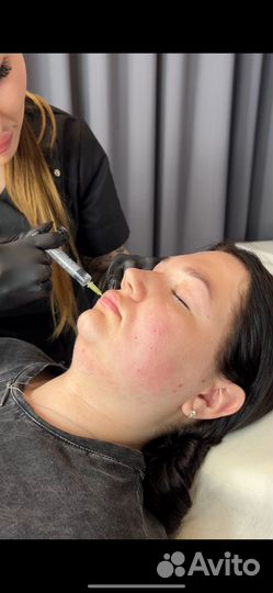 Косметолог худое лицо липолитики