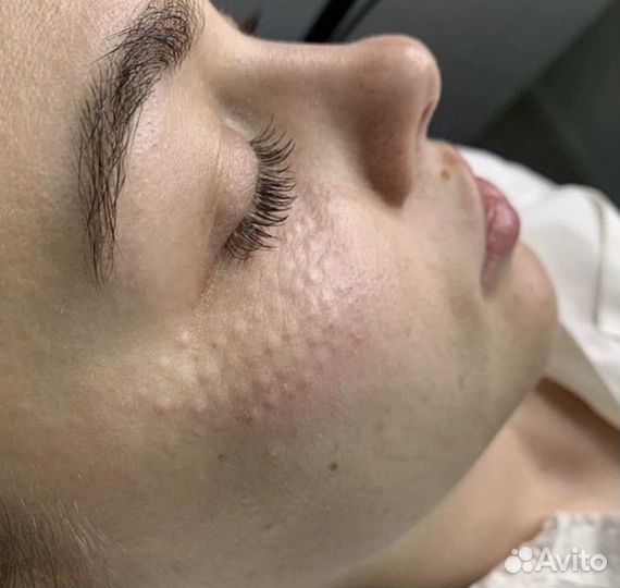 Услуги косметолога