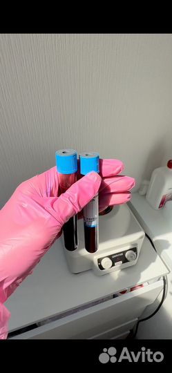 Плазмолифтинг лица