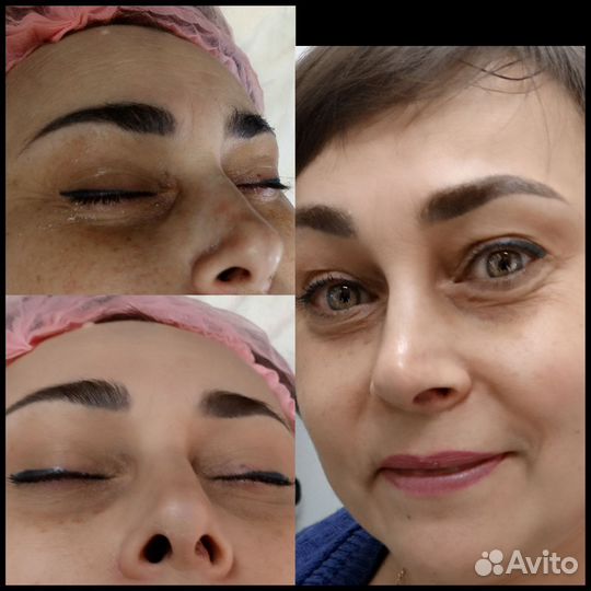 Услуги косметолога