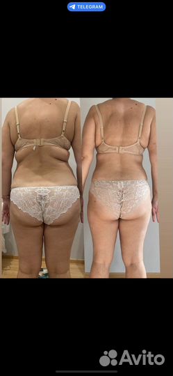 Коррекция фигуры снижение веса