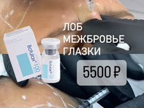 Модели �на Ботулинотерапию (Ботокс)