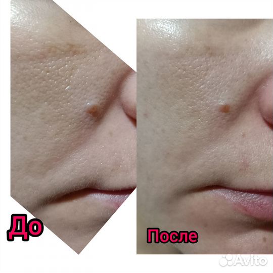 Пептидная и лечебная косметика