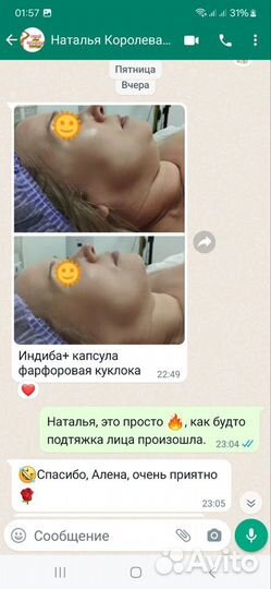 Обучение Индиба/вибромассаж/Ким 8/Ручной массаж