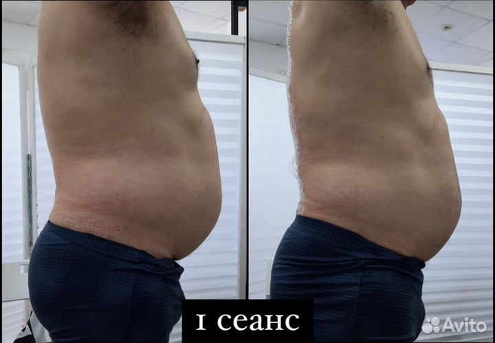 Биоэнергомассаж