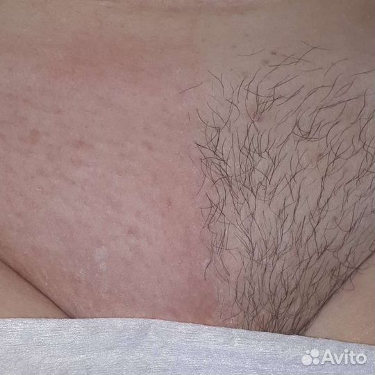 Шугаринг