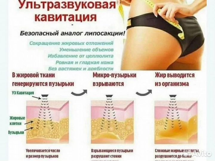 Массаж RF лифтинг