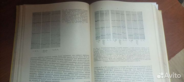 Клиническая кардиология. В.Йонаш. 1968