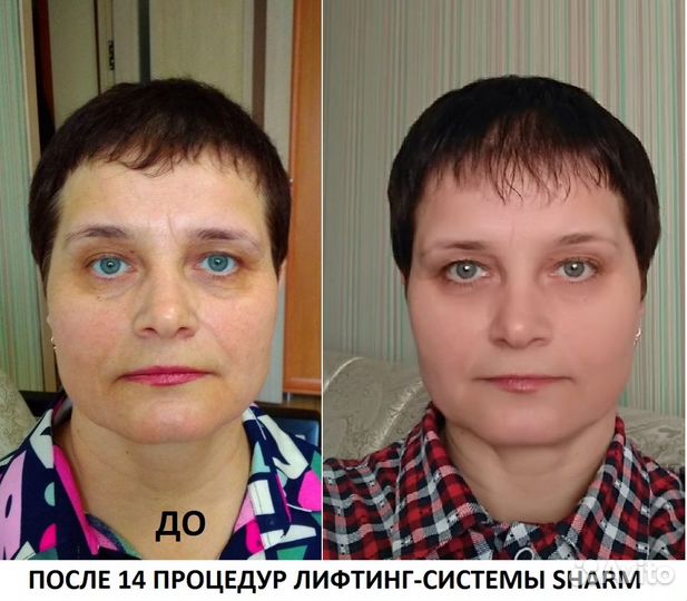 Косметика Hazna для тонуса мышц лица