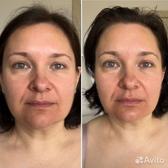 Японский массаж лица